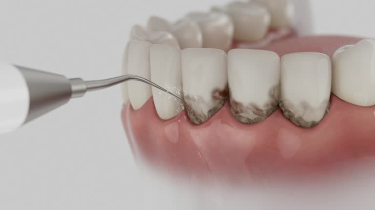 Reliable Dental contractor in Ridgeville, SC by Smile Center Dentistry